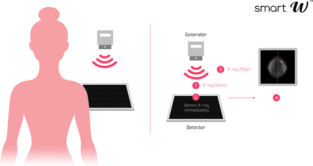 Mammography flat panel in Egypt